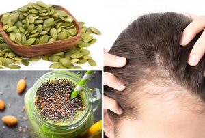 How can I prevent hair loss by eating the right foods?