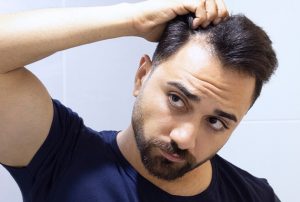 How to Prevent Hair Loss in Men : Tips and solutions