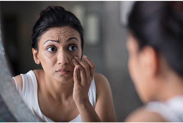 5.What are the causes of dark circles under eyes 1