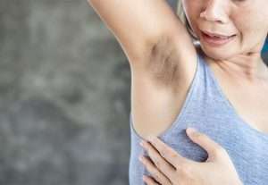 19. Say Goodbye to Dark Underarms How to Effectively Lighten Your Underarms