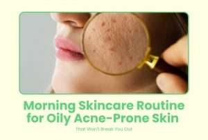 Morning Skincare Routine for Oily Acne-Prone Skin That Won’t Break You Out