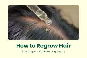 How to Regrow Hair in Bald Spots with Rosemary Serum